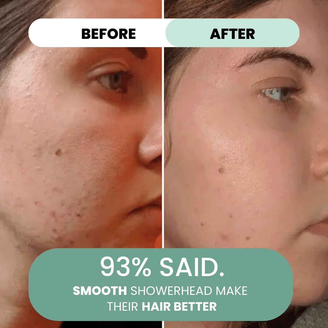 Smooth™ - Filtered ShowerHead For Healthier Skin & Hair - Smooth